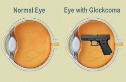Glockcoma-gun-meme.jpg